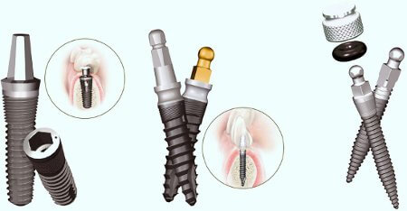 Micro implants